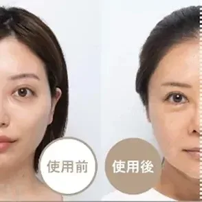 Photo Plus Shiny NEO Cosmetic Device by Ya-man YJFM18N